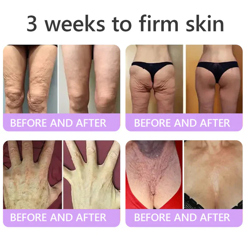 FDA-certified Peptide Massage Roller Cream — offers benefits including anti-aging, moisturizing, firming and lifting, skin repair, evening out skin tone, treating acne and fading spots, removing warts and moles, and alleviating symptoms of psoriasis.