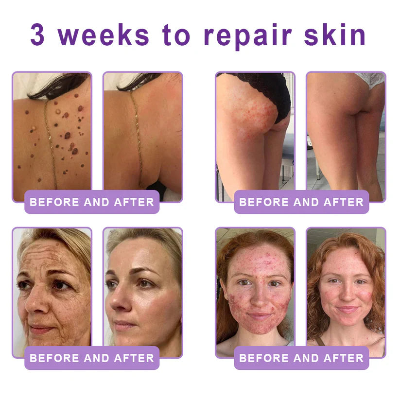 FDA-certified Peptide Massage Roller Cream — offers benefits including anti-aging, moisturizing, firming and lifting, skin repair, evening out skin tone, treating acne and fading spots, removing warts and moles, and alleviating symptoms of psoriasis.