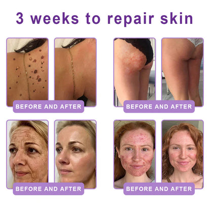 FDA-certified Peptide Massage Roller Cream — offers benefits including anti-aging, moisturizing, firming and lifting, skin repair, evening out skin tone, treating acne and fading spots, removing warts and moles, and alleviating symptoms of psoriasis.