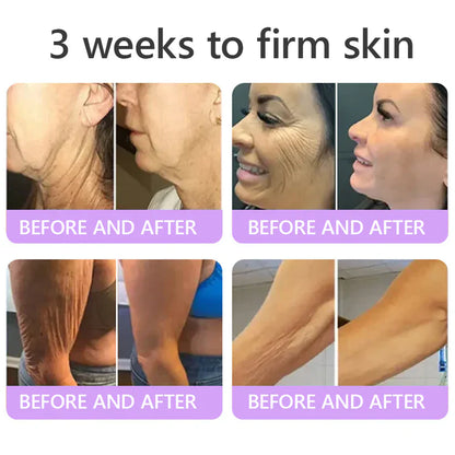 FDA-certified Peptide Massage Roller Cream — offers benefits including anti-aging, moisturizing, firming and lifting, skin repair, evening out skin tone, treating acne and fading spots, removing warts and moles, and alleviating symptoms of psoriasis.