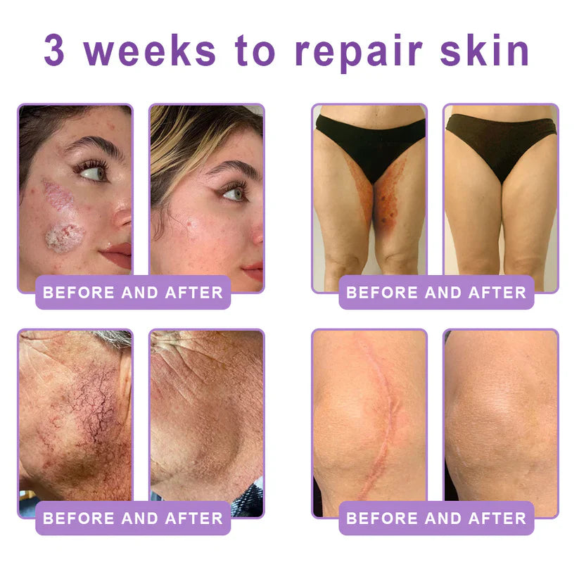 FDA-certified Peptide Massage Roller Cream — offers benefits including anti-aging, moisturizing, firming and lifting, skin repair, evening out skin tone, treating acne and fading spots, removing warts and moles, and alleviating symptoms of psoriasis.