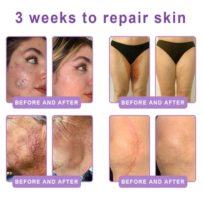 FDA-certified Peptide Massage Roller Cream — offers benefits including anti-aging, moisturizing, firming and lifting, skin repair, evening out skin tone, treating acne and fading spots, removing warts and moles, and alleviating symptoms of psoriasis.