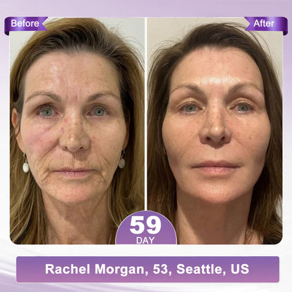FDA-certified Peptide Massage Roller Cream — offers benefits including anti-aging, moisturizing, firming and lifting, skin repair, evening out skin tone, treating acne and fading spots, removing warts and moles, and alleviating symptoms of psoriasis.