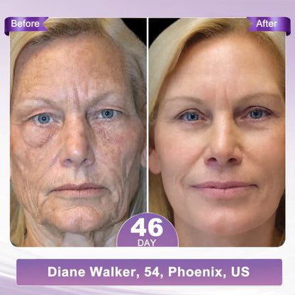 FDA-certified Peptide Massage Roller Cream — offers benefits including anti-aging, moisturizing, firming and lifting, skin repair, evening out skin tone, treating acne and fading spots, removing warts and moles, and alleviating symptoms of psoriasis.